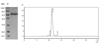 CSB-MP675446HU SDS-PAGE