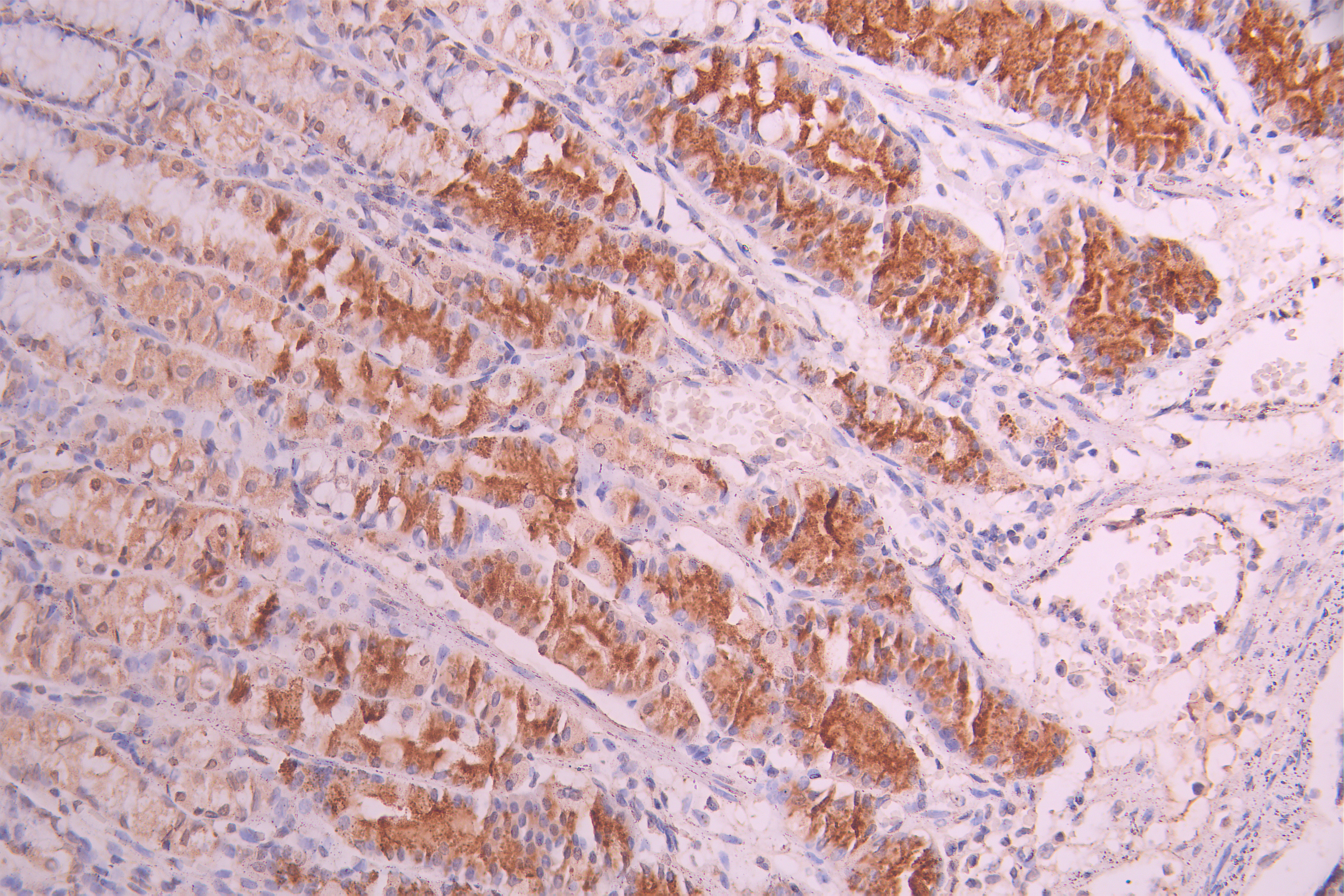 CSB-RA005621MA1HU IHC